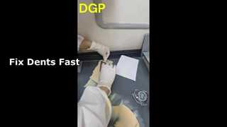 Vücut dolgu maddesi